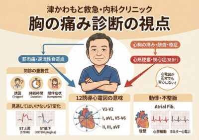 【胸の痛みと心電図検査】胸の痛みがあったら。心筋梗塞・狭心症を見逃さないための診断ポイント|津かわもと救急・内科クリニックのアイキャッチ画像